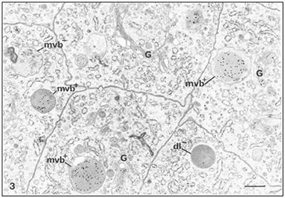 Endocytosis and Enamel Formation